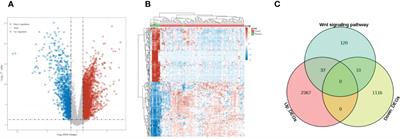 Wnt signaling pathway-related gene PRICKLE1 is a prognostic biomarker for esophageal squamous cell carcinoma